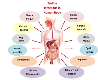 The role of nanocomposites against biofilm infections in humans